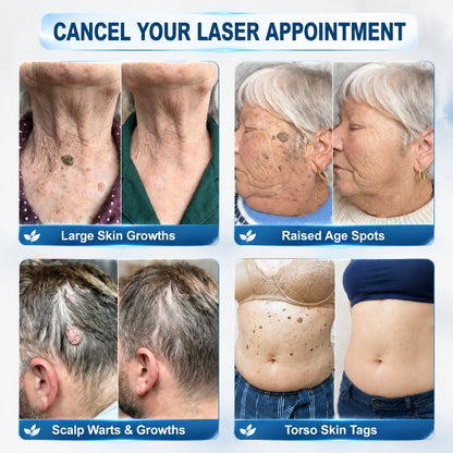 Limited-Time Offer 🎁Congratulations! You are the 269th customer to place an order today! 🎁  Click now to receive 40% OFF your next purchase of 𝐏i𝐜𝐝𝐨® 7-Day Tag & Spot Eraser (Zero Pain, Zero Scars Rollerball Design) 🛒