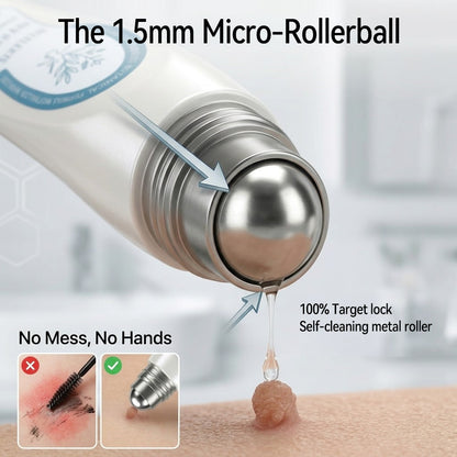 Limited-Time Offer 🎁Congratulations! You are the 269th customer to place an order today! 🎁  Click now to receive 40% OFF your next purchase of 𝐏i𝐜𝐝𝐨® 7-Day Tag & Spot Eraser (Zero Pain, Zero Scars Rollerball Design) 🛒