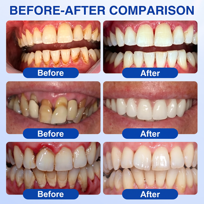 🇮🇪Glimmerly® 🧑‍⚕️💖GumRevive periodontal repair gel
