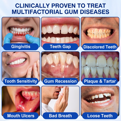 🇮🇪Glimmerly® 🧑‍⚕️💖GumRevive periodontal repair gel