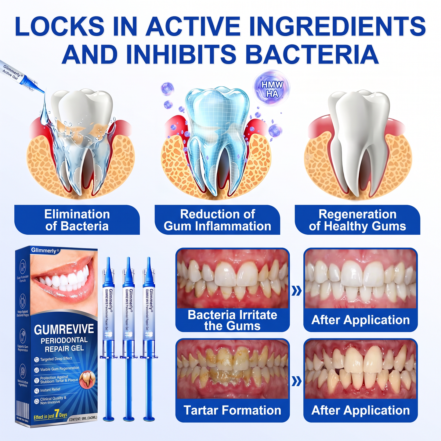 🇮🇪Glimmerly® 🧑‍⚕️💖GumRevive periodontal repair gel