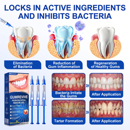 🇮🇪Glimmerly® 🧑‍⚕️💖GumRevive periodontal repair gel